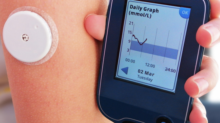 the-best-continuous-glucose-monitoring-system-jordan-hishich